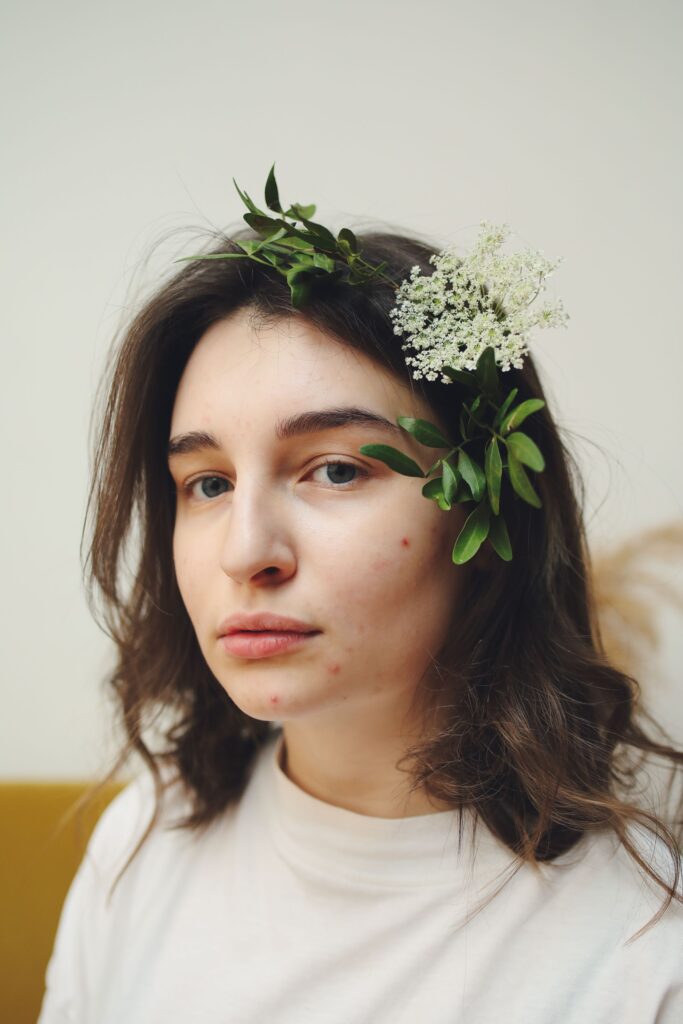Green tea should not displace treatment simply because a botanical ingredient sounds gentler. Painful nodules need proper assessment, while continuing scars indicate that the inflammation is already damaging deeper skin. Treating the acne effectively gives you a better chance of preventing marks and scars that are harder to improve later.